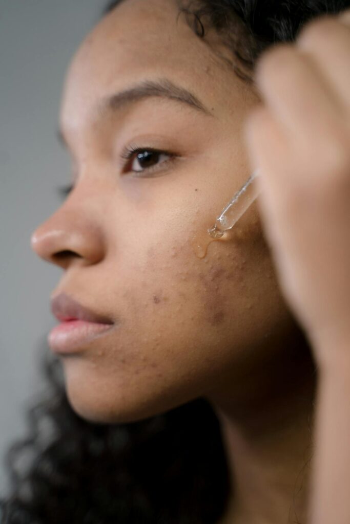 closeup image of a young woman applying skincare serum aha vs bha